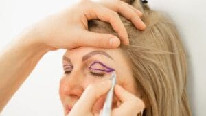 Resultado natural tras una cirugía de blefaroplastia en clínica de medicina estética en Valencia. Tratamiento para rejuvenecer la mirada y eliminar párpados caídos.