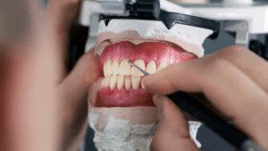 prótesis dentales