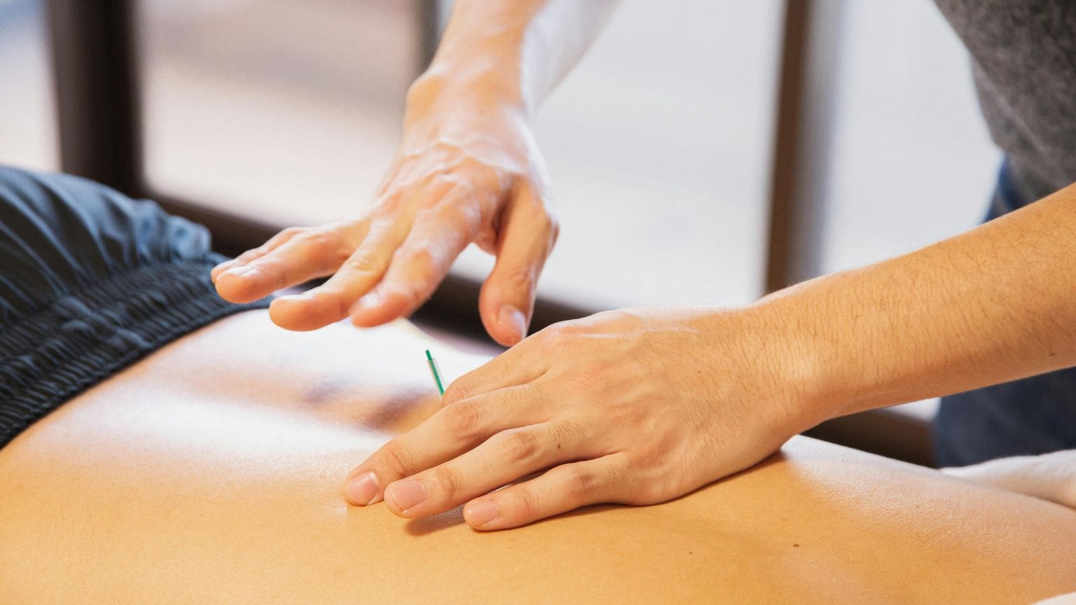 Manos aplicando una sesión de acupuntura sobre la espalda de una persona para aliviar tensiones musculares después del esfuerzo físico, como parte de un tratamiento con terapias naturales.