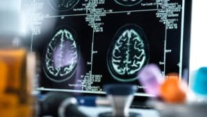 Neurología y Neurofisiología Clínica