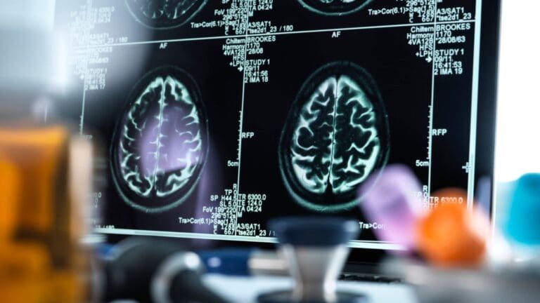 Neurología y Neurofisiología Clínica