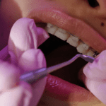 ortodoncia más estética y eficaz
