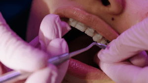 ortodoncia más estética y eficaz