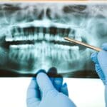 Dentista mostrando radiografía a paciente adulto como parte del diagnóstico previo al tratamiento de endodoncia en clínica dental profesional