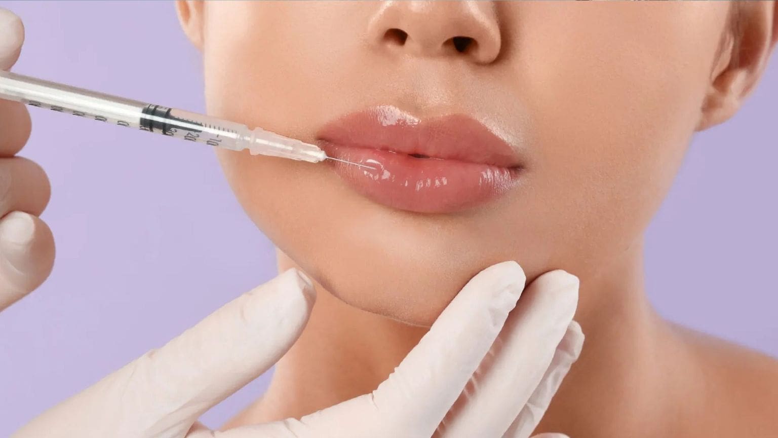 Tratamiento de ácido hialurónico en labios y rostro con resultados naturales