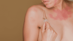 Mujer realizando su rutina de cuidado de la piel en tratamientos oncológicos.