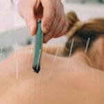 Sesión de acupuntura para el alivio del dolor crónico en un entorno terapéutico profesional y relajante.