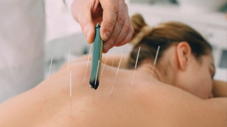 Sesión de acupuntura para el alivio del dolor crónico en un entorno terapéutico profesional y relajante.
