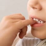 ¿Por qué una mala mordida afecta tu salud general?