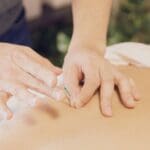 acupuntura en Barcelona realizada en consulta profesional