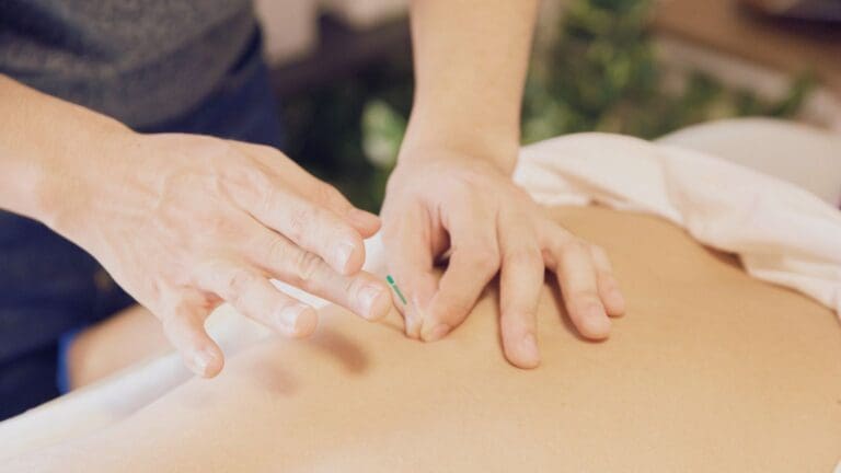 acupuntura en Barcelona realizada en consulta profesional