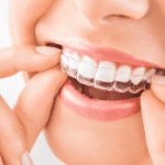 Ortodoncia invisible en adultos ventajas reales frente a los brackets