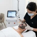 ¿Cuál es el peeling Hollywood precio y qué factores lo determinan?