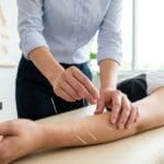 ¿Qué es la acupuntura y cómo funciona esta práctica milenaria?